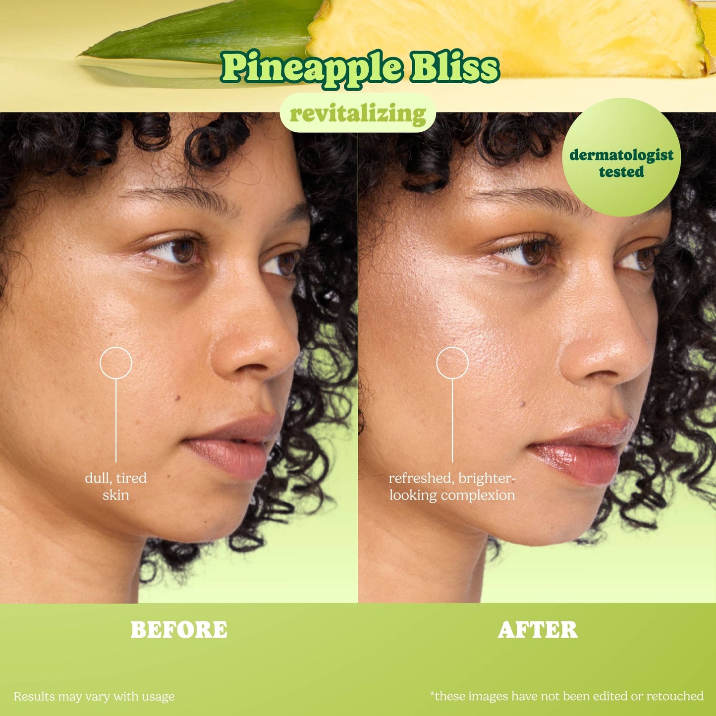 Pineapple Bliss Revitalizing Raw Juice Sheet Mask: With Peg Hole