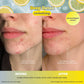 Deep Detox Pore Control Raw Juice Sheet Mask: With Peg Hole