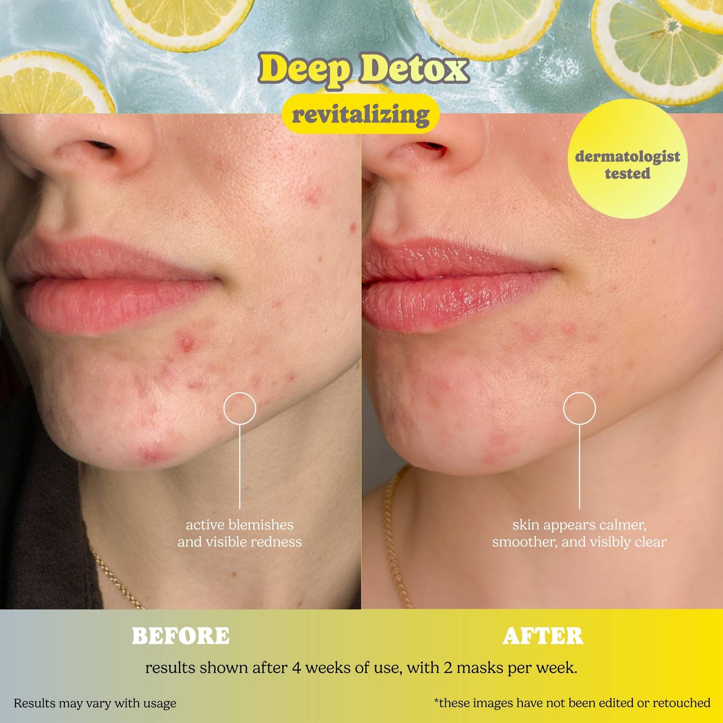 Deep Detox Pore Control Raw Juice Sheet Mask: With Peg Hole